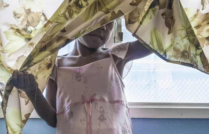 Papua New Guinea: Six-year-old Jane* survived a brutal assault by four men which left her hospitalised and permanently scarred. Photo: Vlad Sokhin.